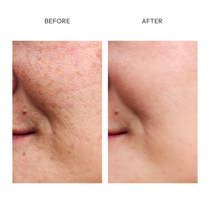 Dark Spot Corrector with Tyrosinase Inhibitors, Niacinamide, Resveratrol, Vitamin C, Kojic Acid