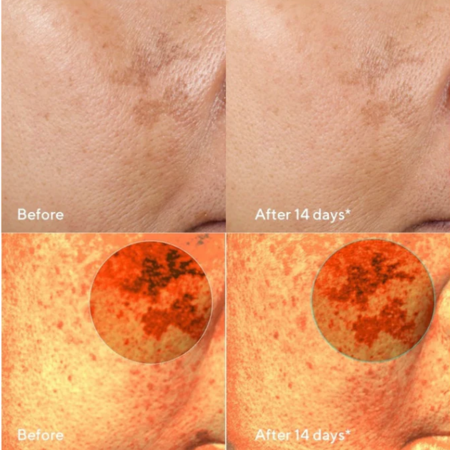 Dark Spot Corrector