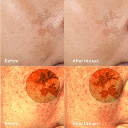 Dark Spot Corrector