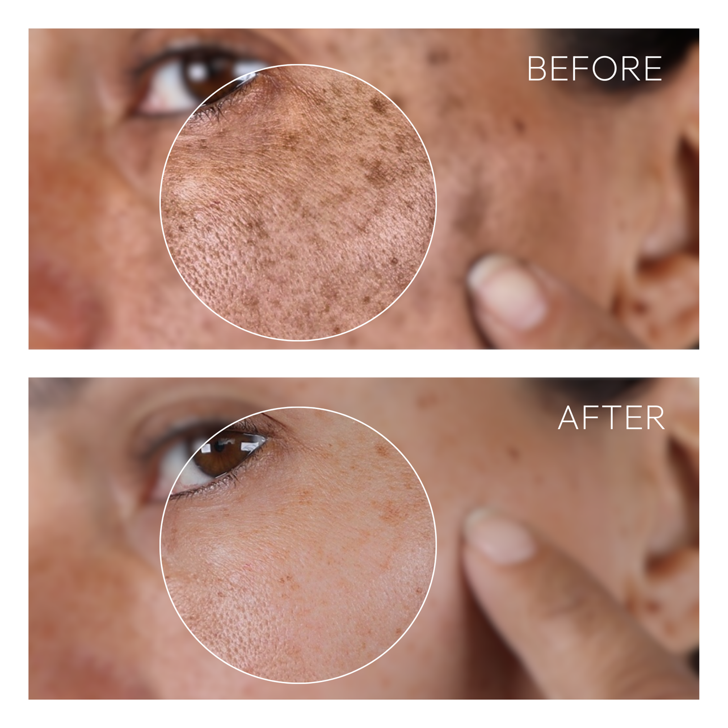 Dark Spot Corrector