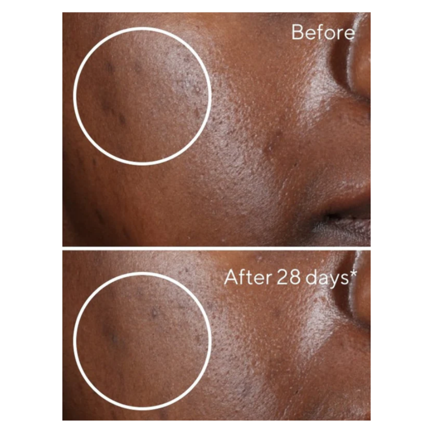 Dark Spot Corrector