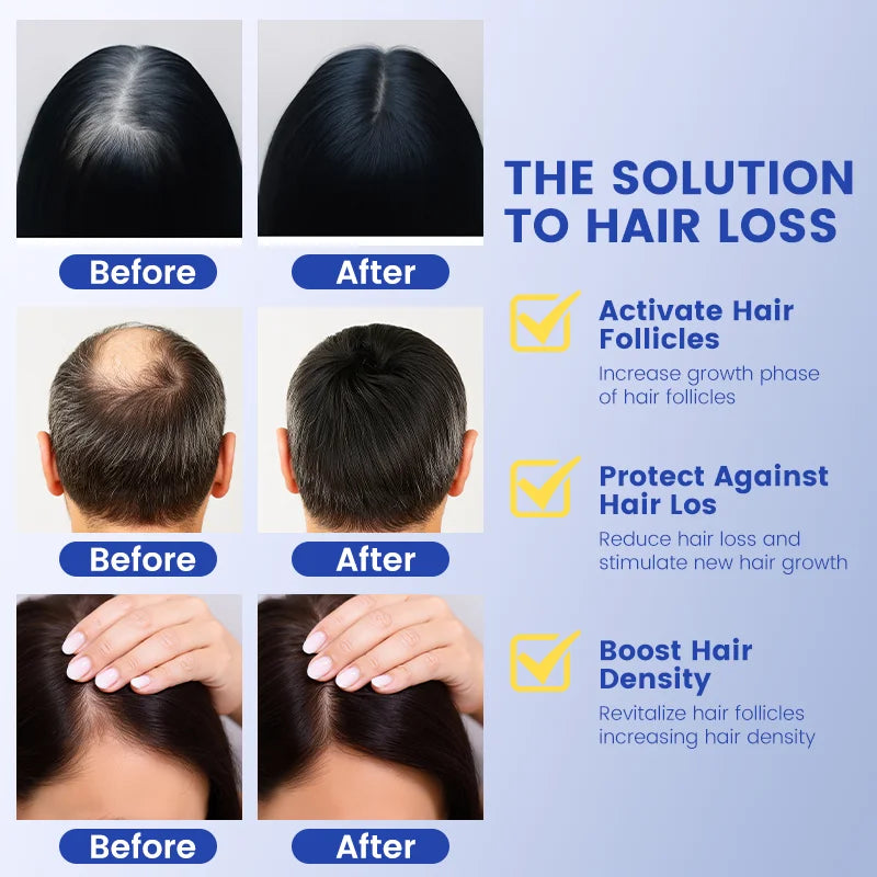 Copper Peptide Serum for Hair Regrowth & Thinning Hair
