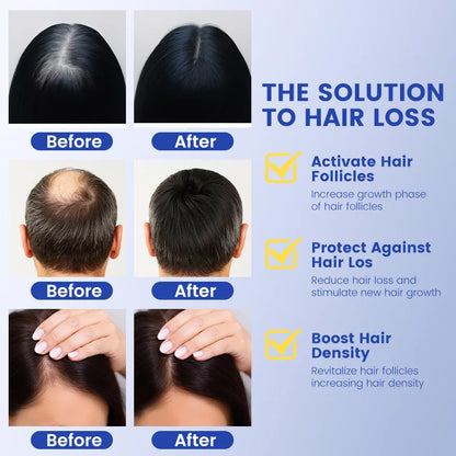 Copper Peptide Serum for Hair Regrowth & Thinning Hair
