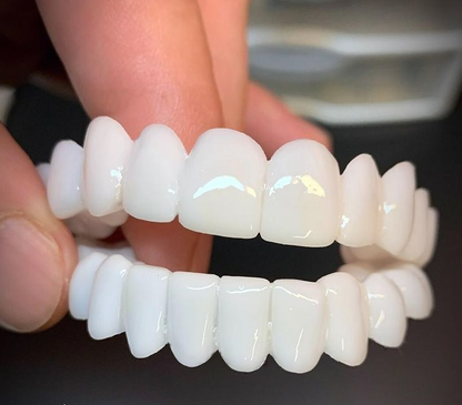 Dental Prosthetics for Missing Teeth & Smile Restoration