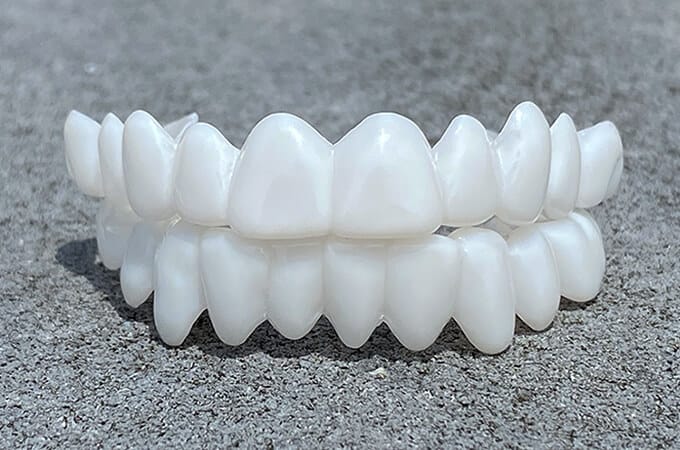 Dental Prosthetics for Missing Teeth & Smile Restoration