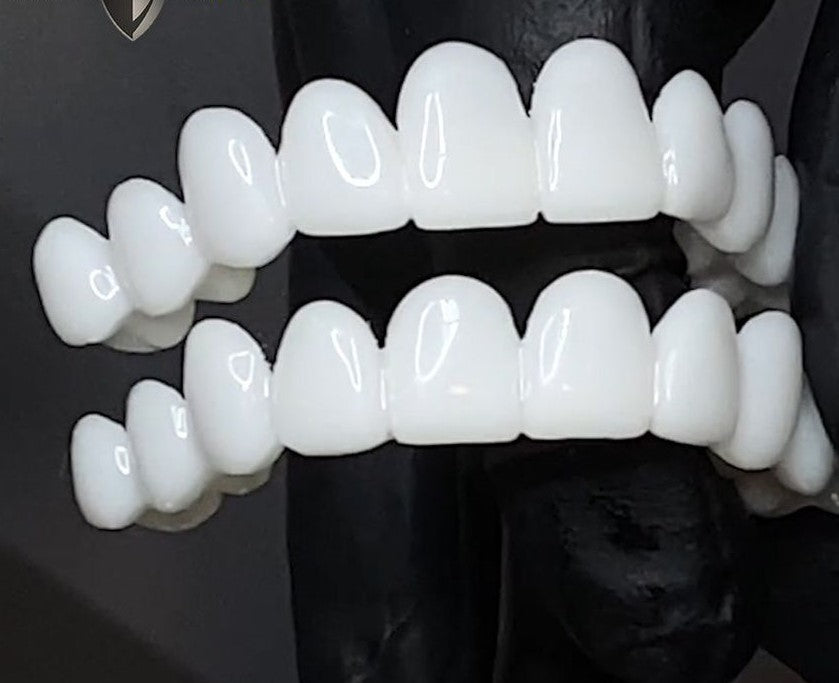 Dental Prosthetics for Missing Teeth & Smile Restoration